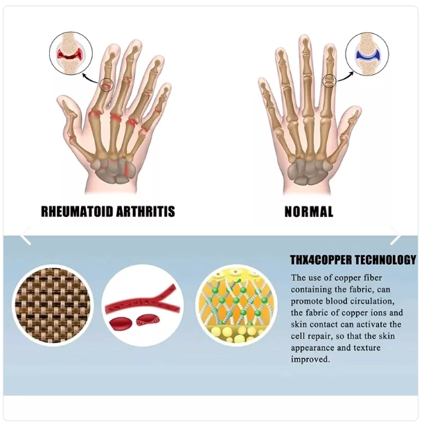 GUANTES ANTICARPIO ™ |Guantes Compresión Túnel Carpiano